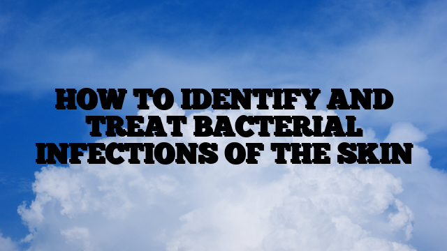 HOW TO IDENTIFY AND TREAT BACTERIAL INFECTIONS OF THE SKIN